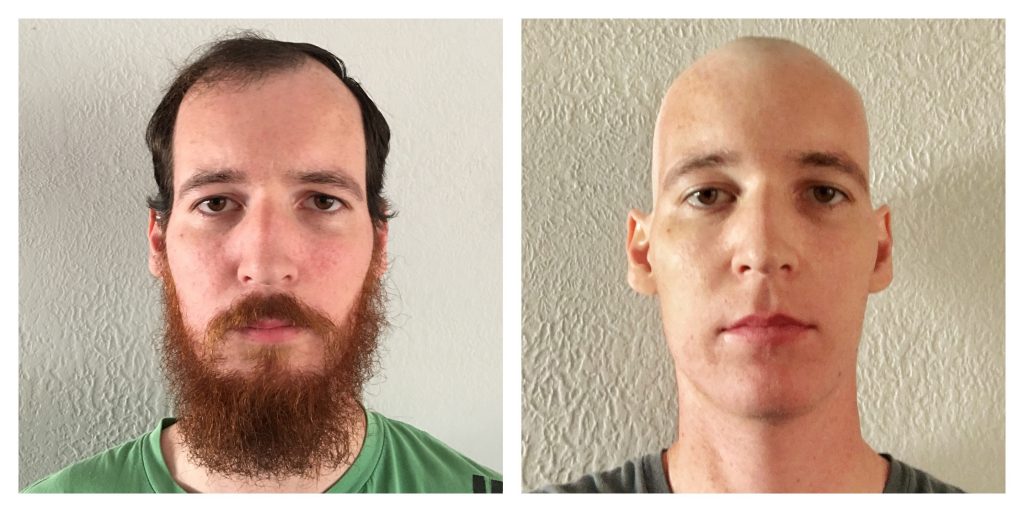 Before and After